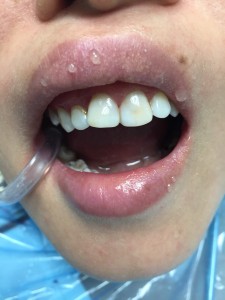 IMG-63cbfb07d3e157d9004e4ed93d3a9fa0-V