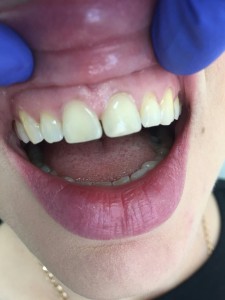 IMG-d1b964fb6353f623c21b6b7aac05666f-V